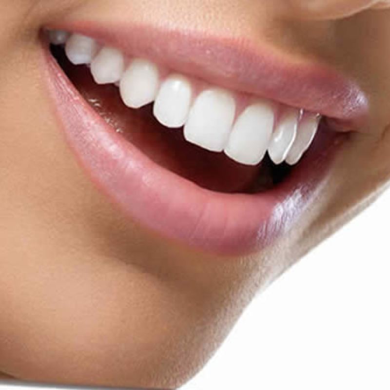 Blanchiment des dents