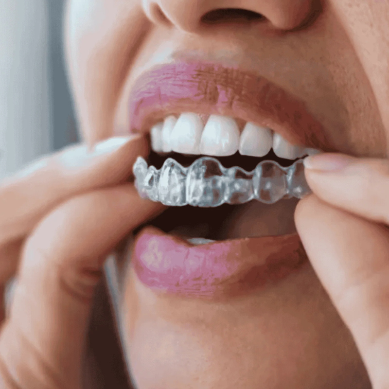 Pourquoi les prothèses sentent mauvais