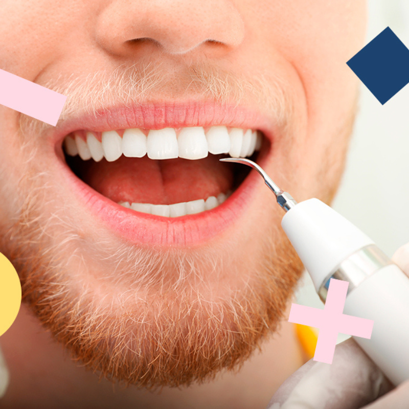 Comment enlever le tartre sans abîmer l’émail