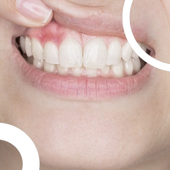 Dentition parfaite