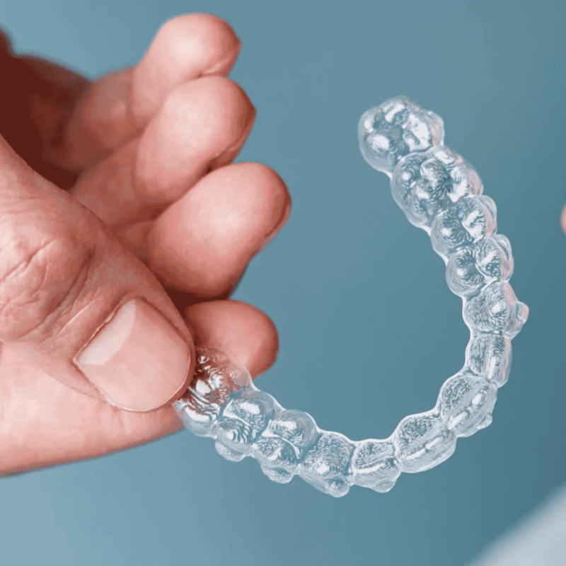 Aligners dentaires : comment éviter les odeurs et les bactéries