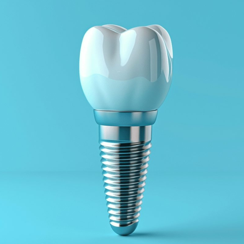 Implants dentaires : comment éviter les infections et prolonger leur durée de vie