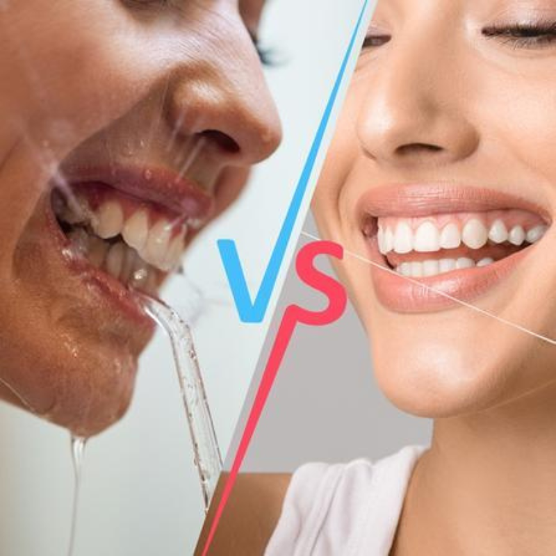 Jet dentaire : est-ce vraiment plus efficace que le fil dentaire ?