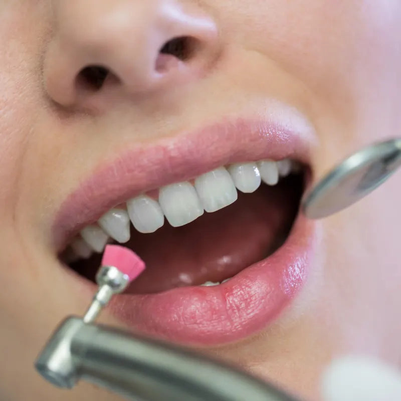Comment détartrer les dents sans dentiste : est-ce vraiment possible ?
